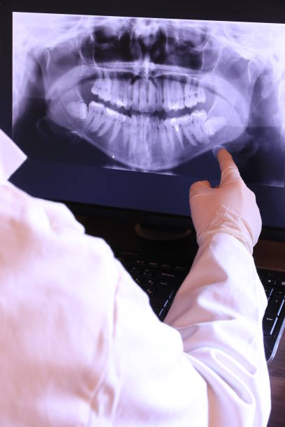Best Broken or Chipped Tooth Repair in Montezuma, GA