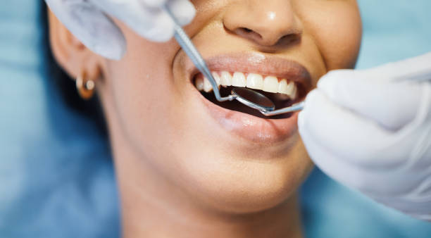 Best Emergency Treatment for Oral Infections in Montezuma, GA