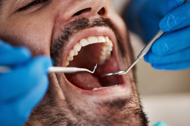 Best Emergency Root Canal Therapy in Montezuma, GA